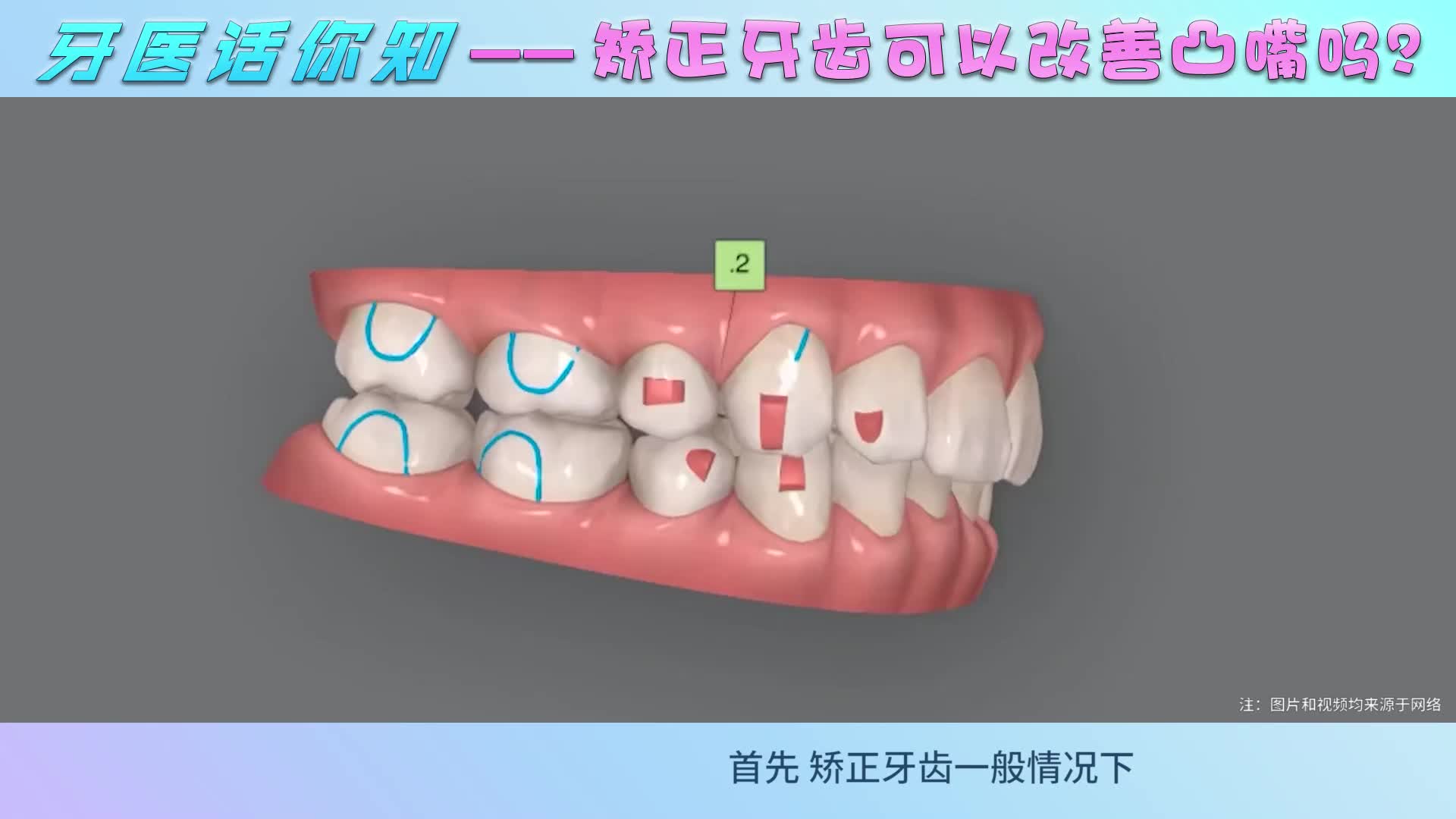 想要改善凸嘴，专家给出2个好办法！